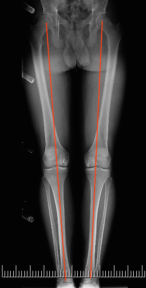 健康・医学 The Art of Limb Alignment, 12th Edition The Art of Limb Alignment, Twelfth Edition: Standard, Shawn